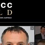 SMACC GOLD Featured