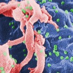 HIV Featured