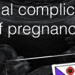 medical complications pregnancy featured