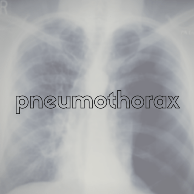 pneumothorax