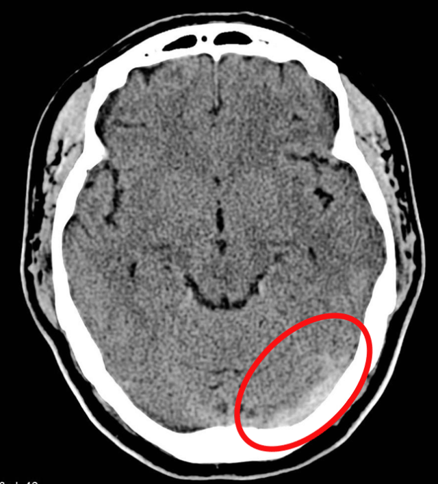 Radiopaedia - Drawing Main branches of the mandibular nerve - English  labels